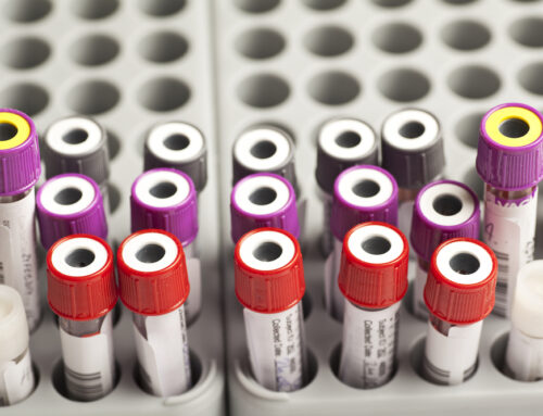 Preventive Bloodwork for Dogs and Cats: Catching Problems Early